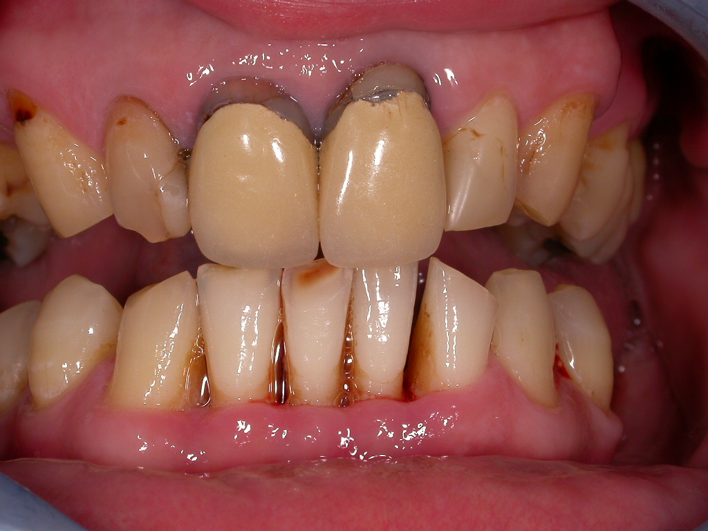 Patient mit unzufriedener Gesamtsituation